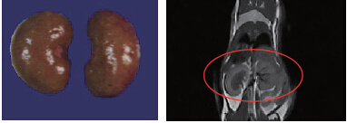 MRI(1T)СӋ